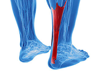 Achilles tendonitis treatment in the San Juan, 00924, Puerto Rico area